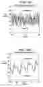 Fig. 08 - SYSTEMS AND METHODS FOR DETERMINING INTRACRANIAL PRESSURE NON-INVASIVELY AND ACOUSTIC TRANSDUCER ASSEMBLIES FOR USE IN SUCH SYSTEMS