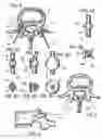 Fig. 04 - Guide pin for pedicle screw placement and method for use of such guide pin in spinal fusion surgeries