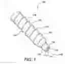 Fig. 02 - Suture anchor