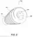 Fig. 09 - Suture anchor