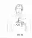 Fig. 02 - TRANSVASCULAR NEURAL STIMULATION DEVICE