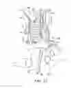 Fig. 07 - TRANSVASCULAR NEURAL STIMULATION DEVICE