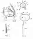 Fig. 04 - Implanted cardiac device for defibrillation