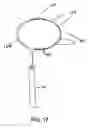 Fig. 09 - Implanted cardiac device for defibrillation