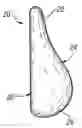 Fig. 01 - FORM STABLE BREAST IMPLANT SIZER AND METHOD OF USE