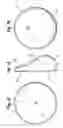 Fig. 02 - FORM STABLE BREAST IMPLANT SIZER AND METHOD OF USE
