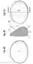 Fig. 03 - FORM STABLE BREAST IMPLANT SIZER AND METHOD OF USE