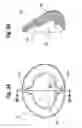 Fig. 06 - FORM STABLE BREAST IMPLANT SIZER AND METHOD OF USE