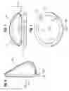 Fig. 07 - FORM STABLE BREAST IMPLANT SIZER AND METHOD OF USE