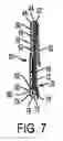 Fig. 05 - Belt support