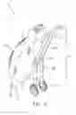 Fig. 02 - Golf bag structure