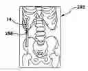 Fig. 01 - Radiological scanning orientation indicator