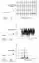 Fig. 03 - Audible event detector and analyzer for annunciating to the hearing impaired