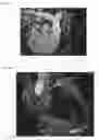 Fig. 08 - Dynamic pulmonary trunk modeling in computed tomography and magnetic resonance imaging based on the detection of bounding boxes, anatomical landmarks, and ribs of a pulmonary artery
