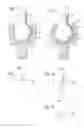 Fig. 02 - Ball joint