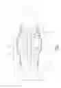 Fig. 02 - Radial loading element for turbine vane