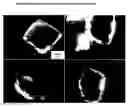 Fig. 01 - INJECTABLE NANOPARTICULATE OLANZAPINE FORMULATIONS