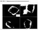 Fig. 02 - INJECTABLE NANOPARTICULATE OLANZAPINE FORMULATIONS