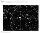 Fig. 04 - INJECTABLE NANOPARTICULATE OLANZAPINE FORMULATIONS