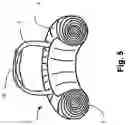 Fig. 05 - Medical device and a method for applying a biochemically active material on one or more body parts