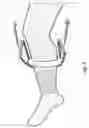 Fig. 06 - Medical device and a method for applying a biochemically active material on one or more body parts