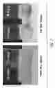 Fig. 03 - Microemulsion containing indolocarbazole compound and dosage forms containing the same