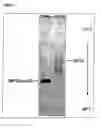 Fig. 02 - Method of treating diseases or abnormal conditions of periodontal or dental tissues with GDF5