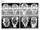 Fig. 15 - Method of treating diseases or abnormal conditions of periodontal or dental tissues with GDF5
