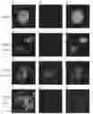 Fig. 01 - Methods of NAD-dependent deacetylation of a lysine residue in a protein