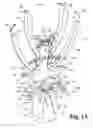 Fig. 08 - Instruments and methods for minimally invasive tissue retraction and surgery