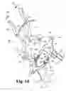 Fig. 09 - Instruments and methods for minimally invasive tissue retraction and surgery