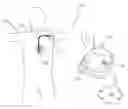 Fig. 01 - System for contextual display of data from an implantable medical device