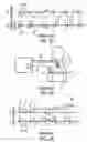 Fig. 03 - Methods and devices for sensing respiration and providing ventilation therapy