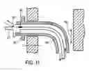 Fig. 08 - Methods and devices for sensing respiration and providing ventilation therapy