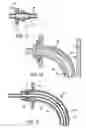 Fig. 10 - Methods and devices for sensing respiration and providing ventilation therapy