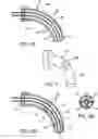 Fig. 11 - Methods and devices for sensing respiration and providing ventilation therapy