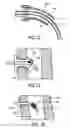 Fig. 14 - Methods and devices for sensing respiration and providing ventilation therapy