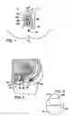 Fig. 02 - DIAGNOSTIC INTERLABIAL PAD