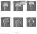Fig. 02 - ROTATOR CUFF PATCH DELIVERY DEVICE