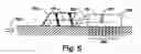 Fig. 06 - Hydraulically actuated pump for long duration medicament administration