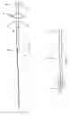 Fig. 03 - System and method for implanting a catheter