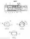 Fig. 04 - System and method for implanting a catheter