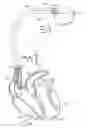 Fig. 01 - Motion-based optimization for placement of cardiac stimulation electrodes
