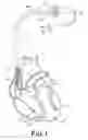 Fig. 02 - Motion-based optimization for placement of cardiac stimulation electrodes