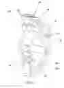 Fig. 08 - Energy transfer machine with inner rotor
