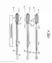 Fig. 10 - Method for permanent occlusion of fallopian tube