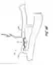 Fig. 12 - Method for permanent occlusion of fallopian tube