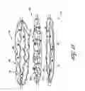 Fig. 16 - Method for permanent occlusion of fallopian tube