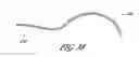 Fig. 34 - Method for permanent occlusion of fallopian tube