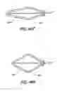 Fig. 40 - Method for permanent occlusion of fallopian tube
